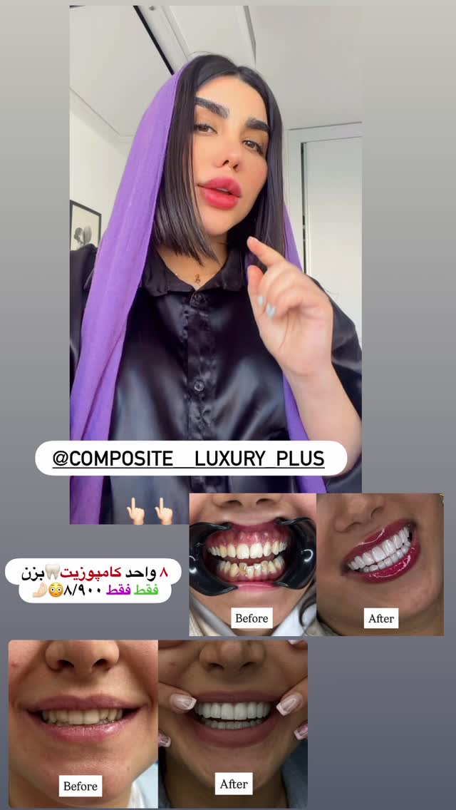  جدید ترین استوری اینستاگرام پری آ