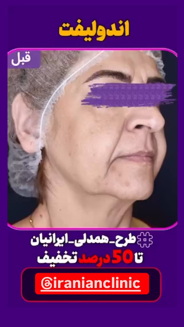  جدید ترین استوری اینستاگرام فرشیده کوچک