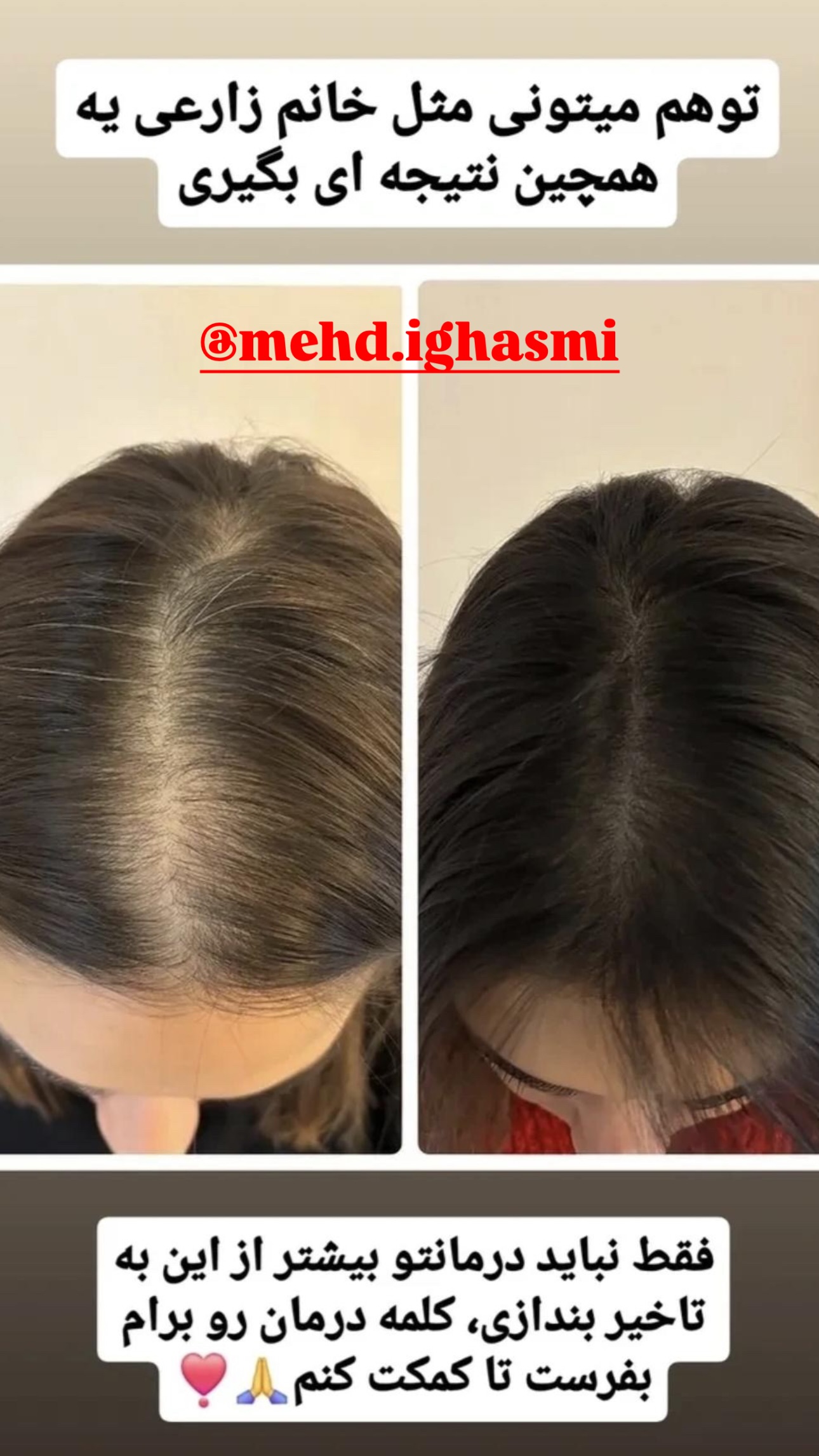  جدید ترین استوری اینستاگرام فرشیده کوچک