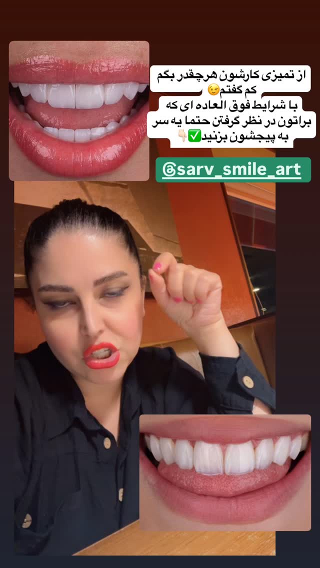  جدید ترین استوری اینستاگرام فرشیده کوچک