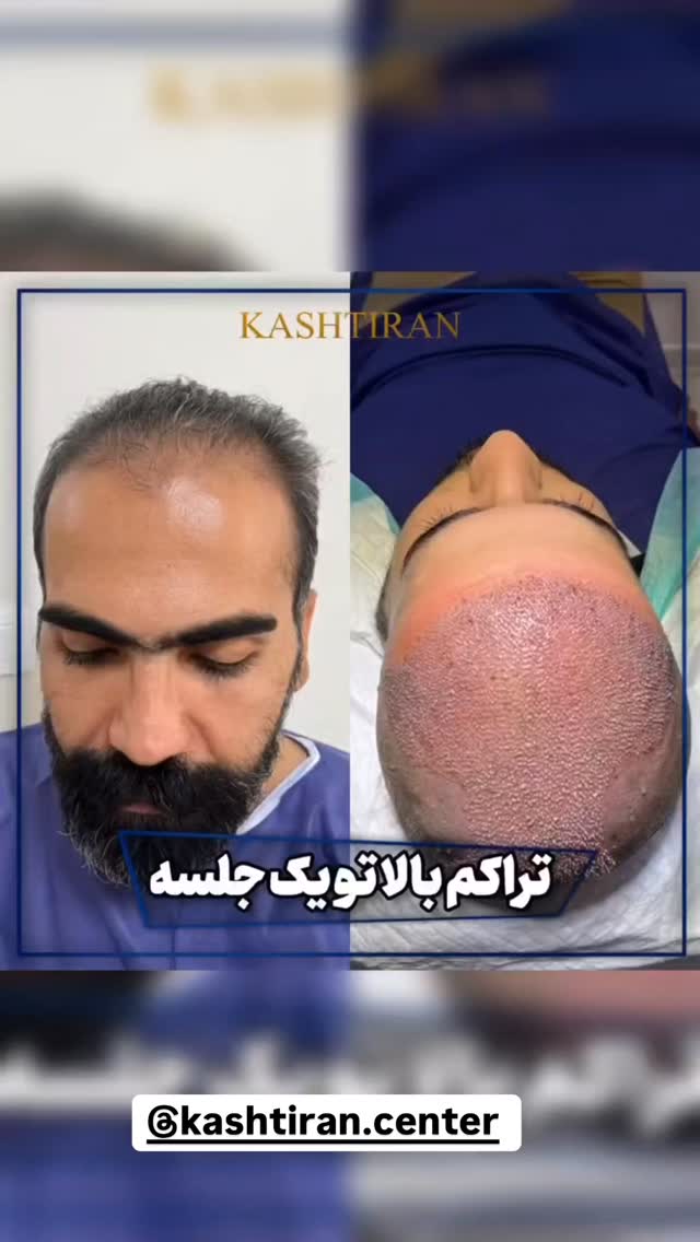  جدید ترین استوری اینستاگرام فرشیده کوچک