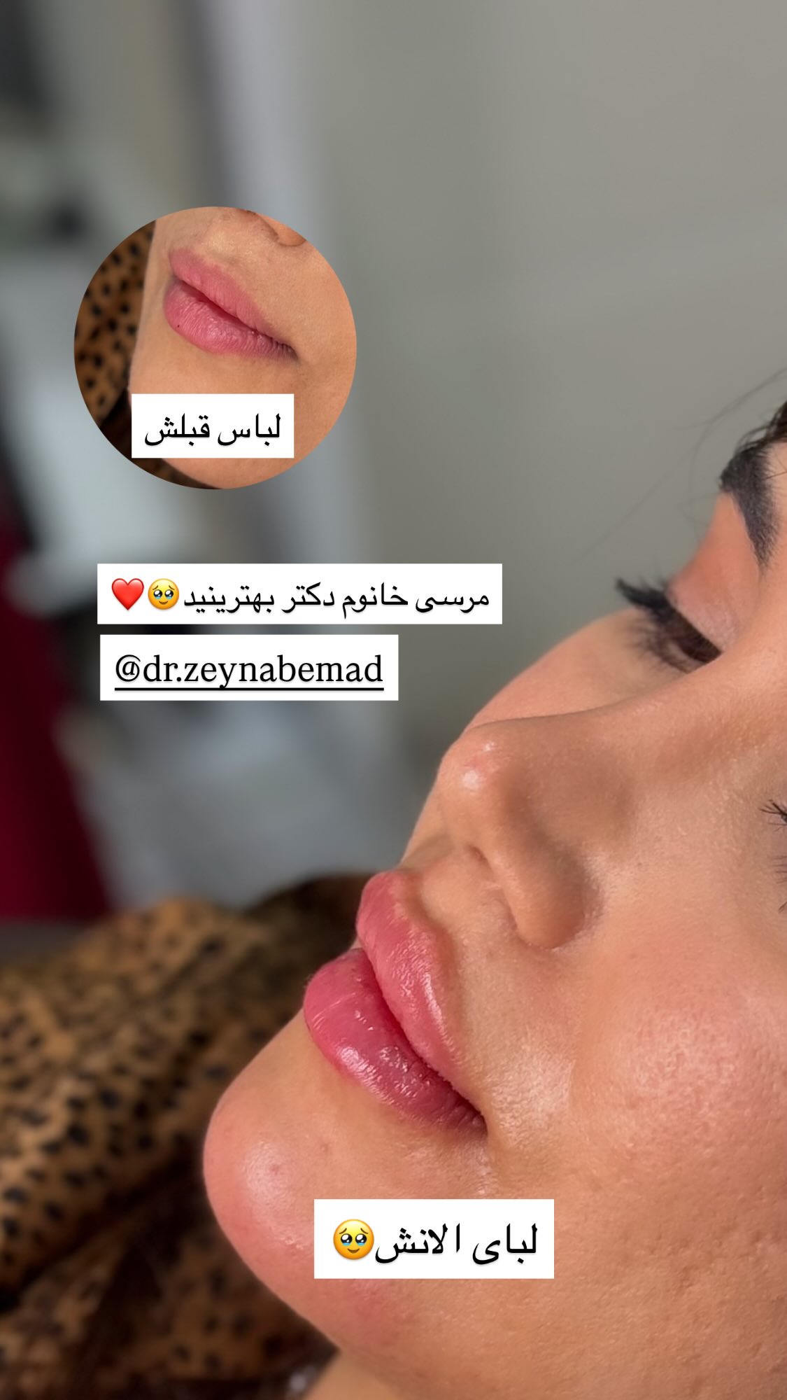  جدید ترین استوری اینستاگرام پروانه خوشبین