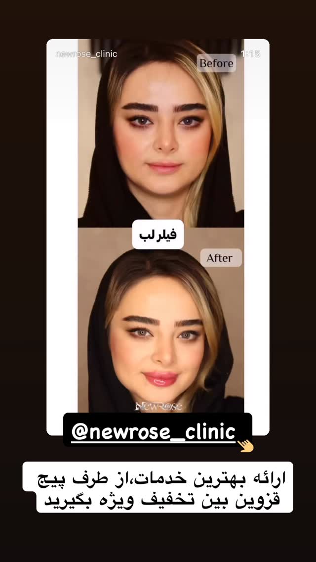  جدید ترین استوری اینستاگرام قزوین بین