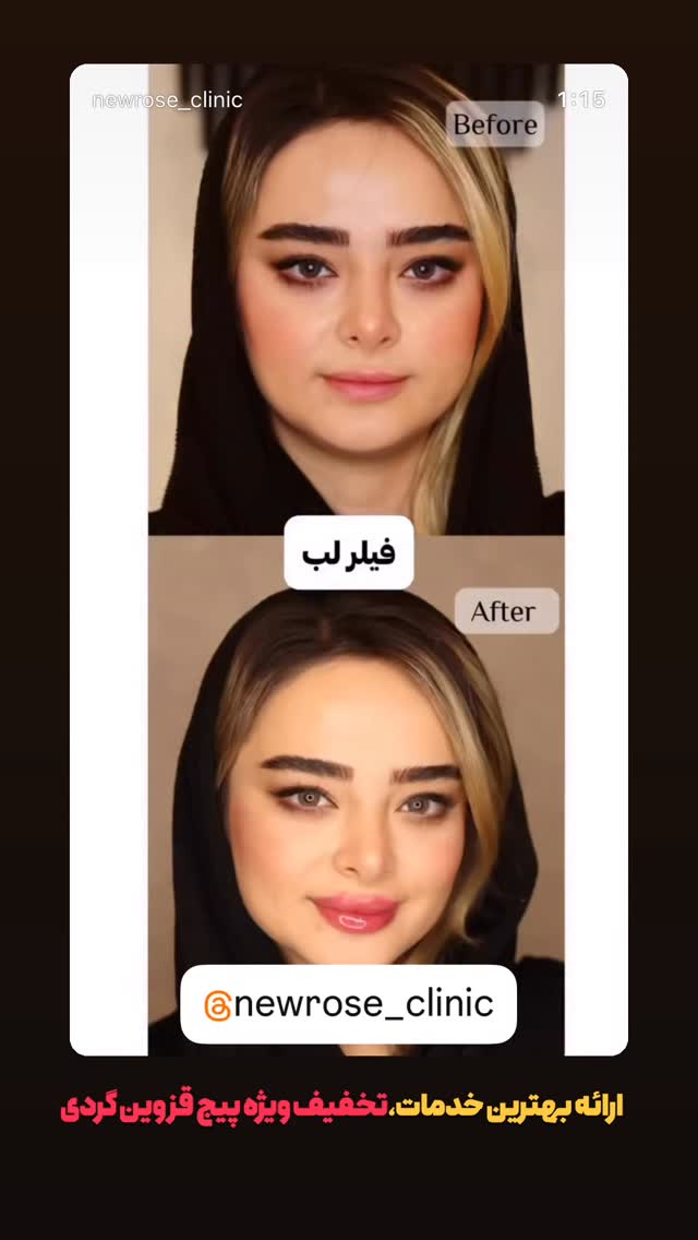  جدید ترین استوری اینستاگرام قزوینگردی