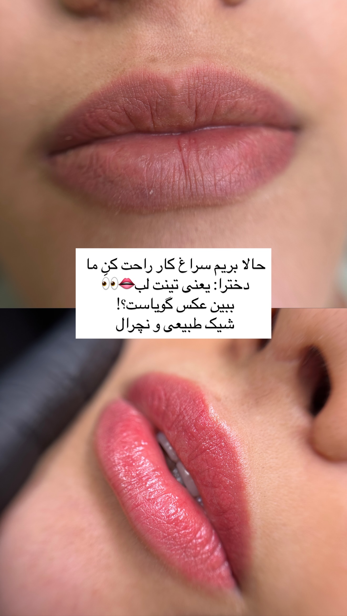  جدید ترین استوری اینستاگرام رهای