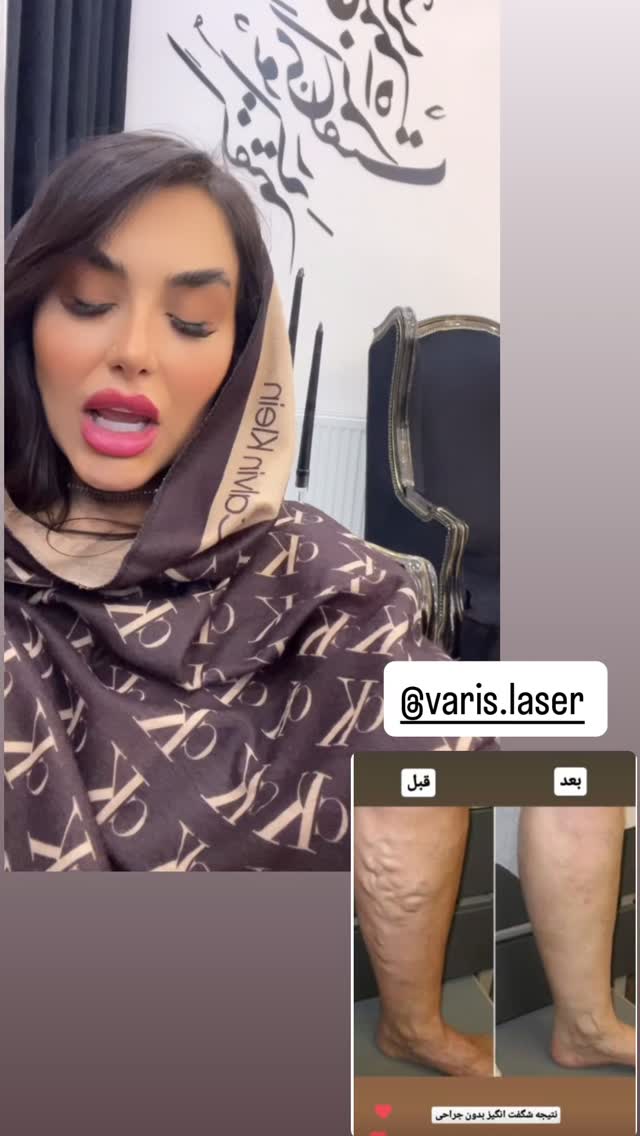  جدید ترین استوری اینستاگرام عاطفه عزیزی