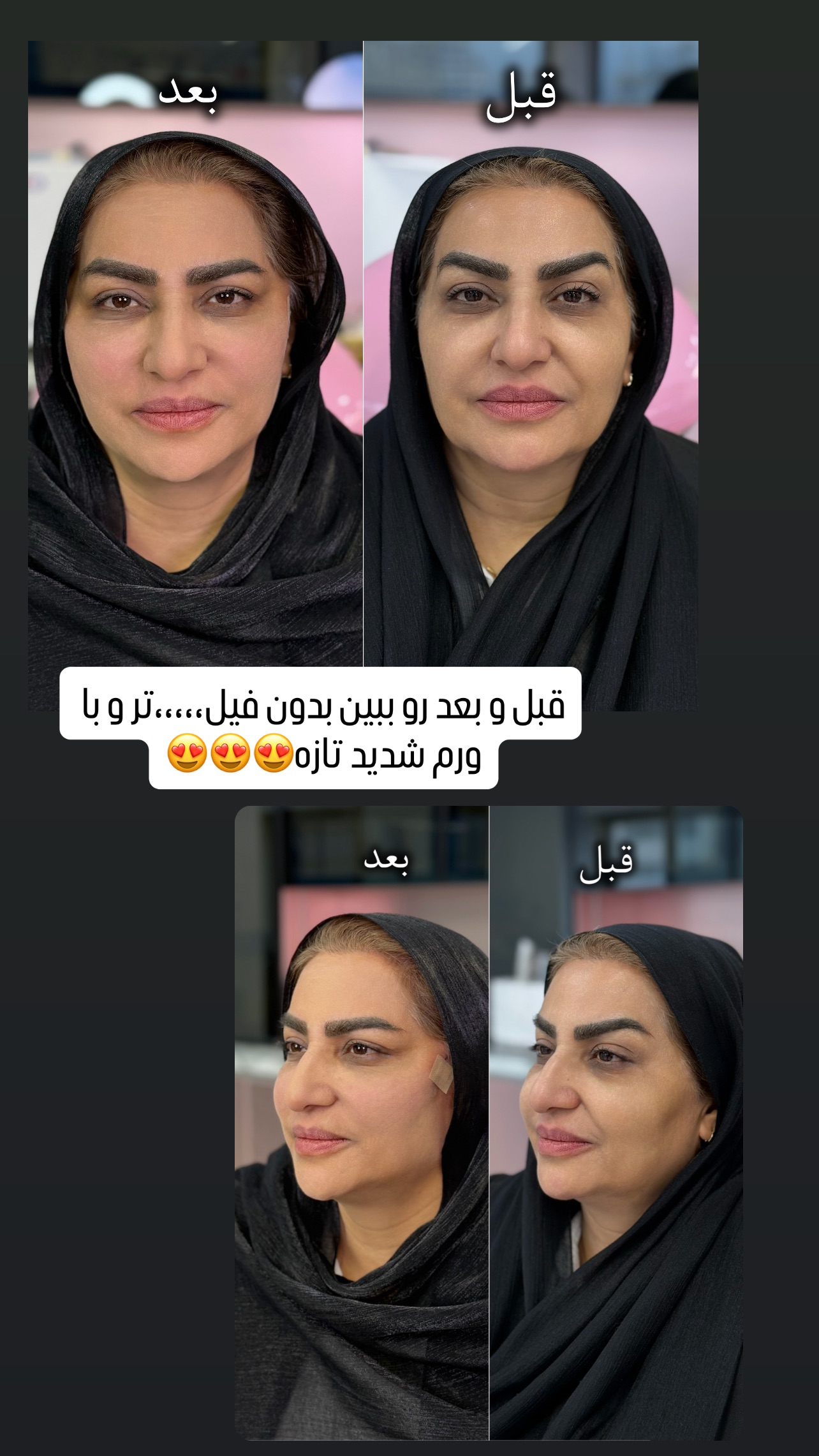  جدید ترین استوری اینستاگرام عاطفه عزیزی
