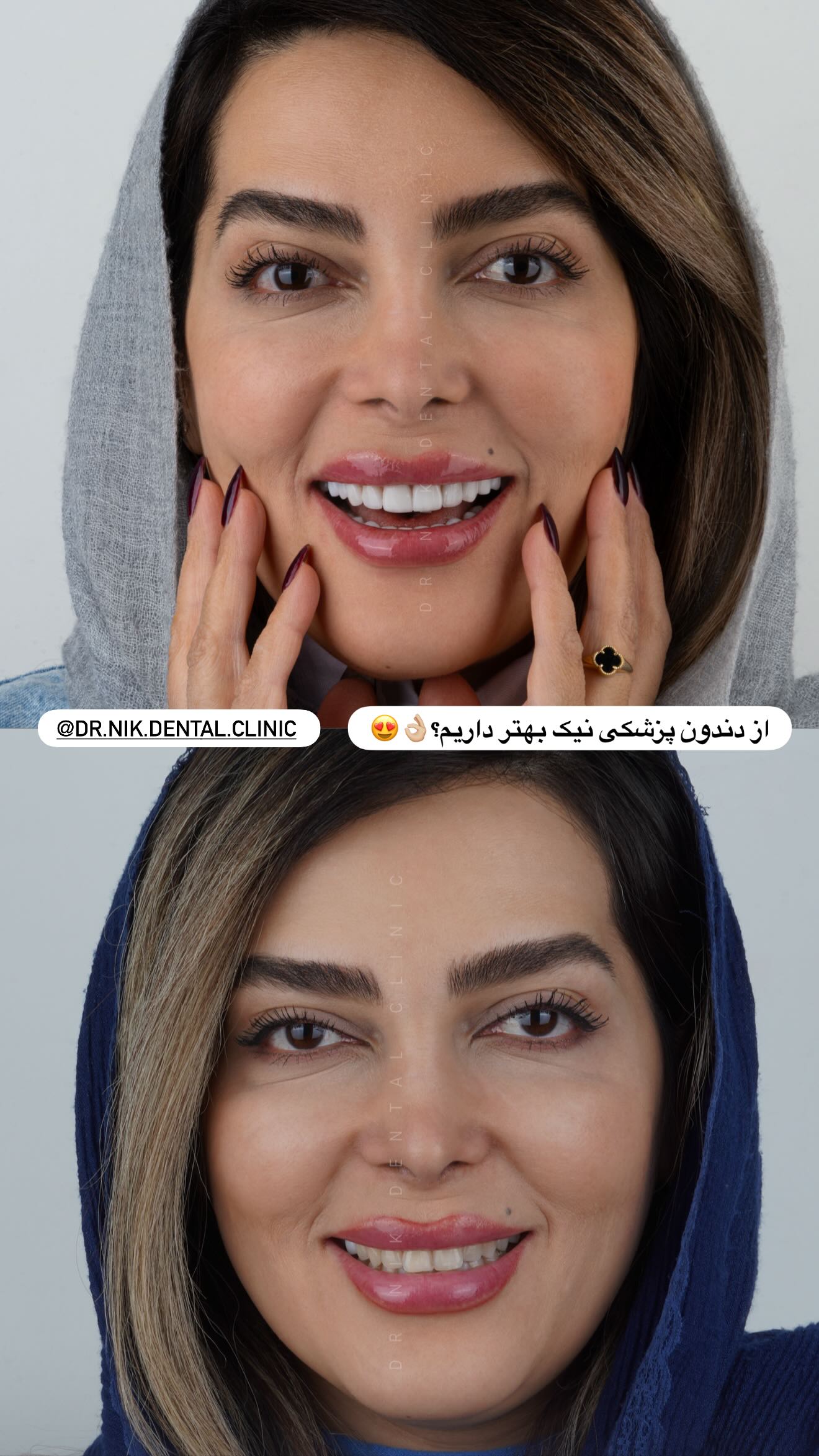  جدید ترین استوری اینستاگرام ریحانه رجب زاده
