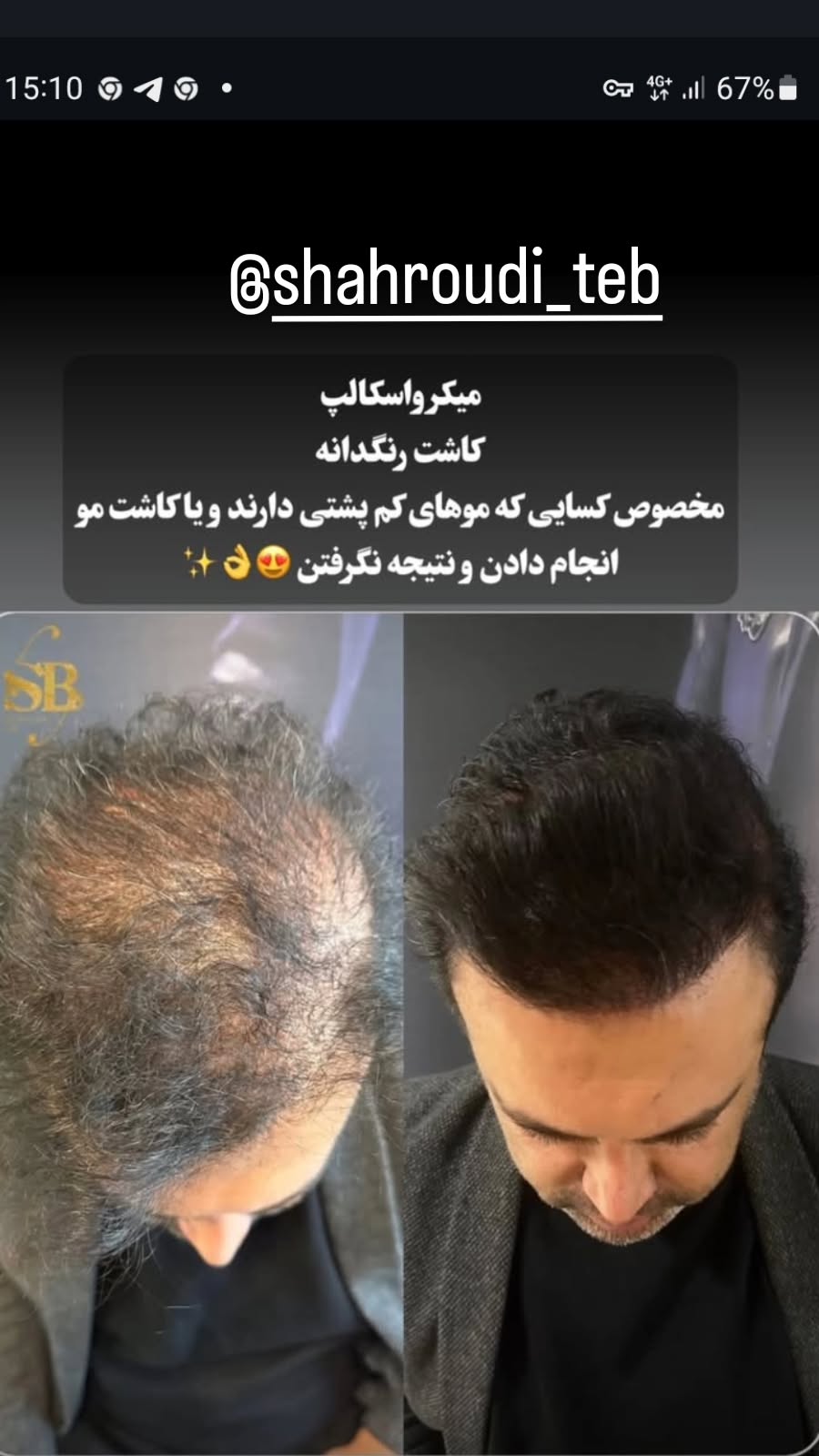 جدید ترین استوری اینستاگرام رضا شاهرودی