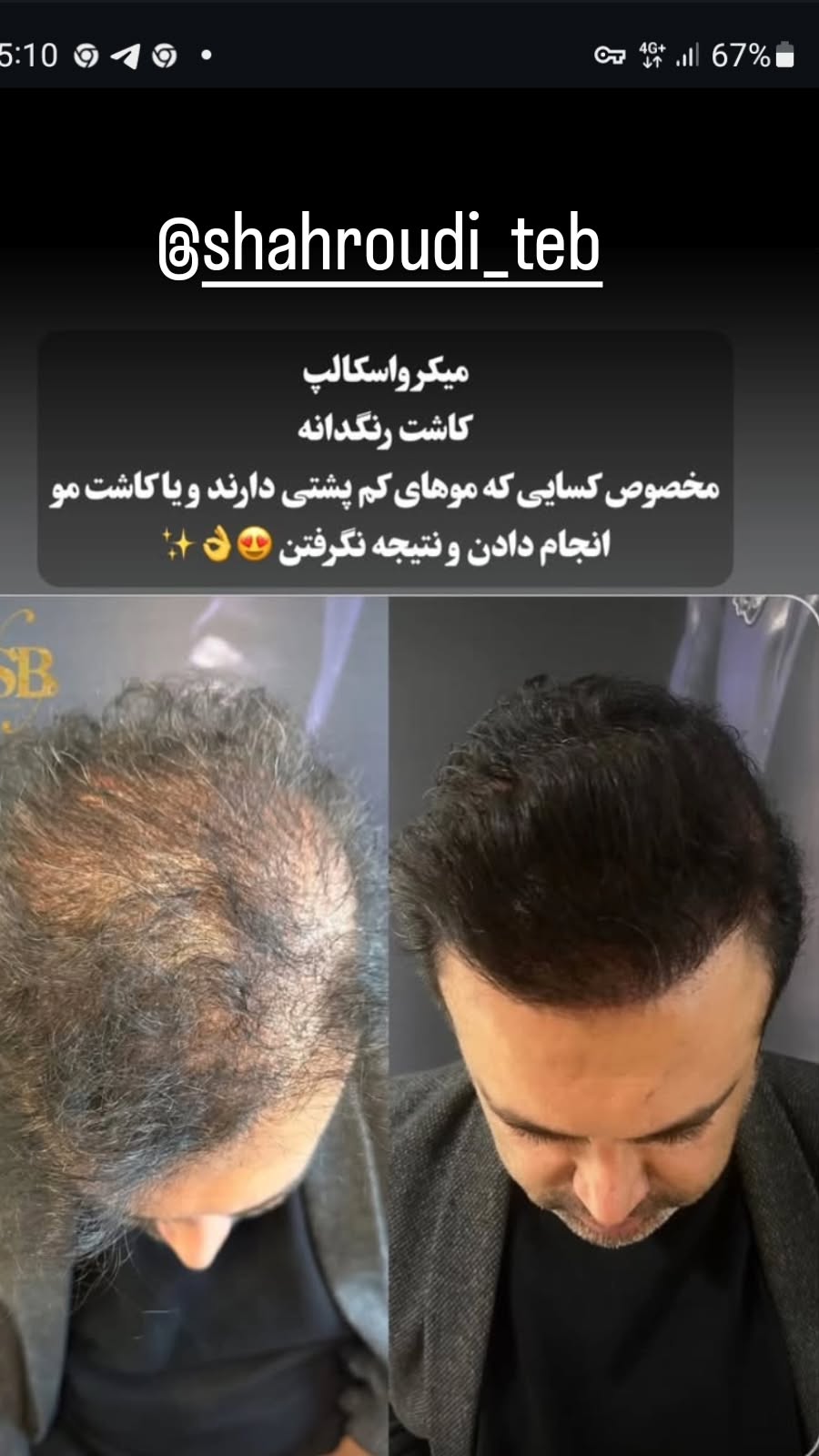  جدید ترین استوری اینستاگرام رضا شاهرودی