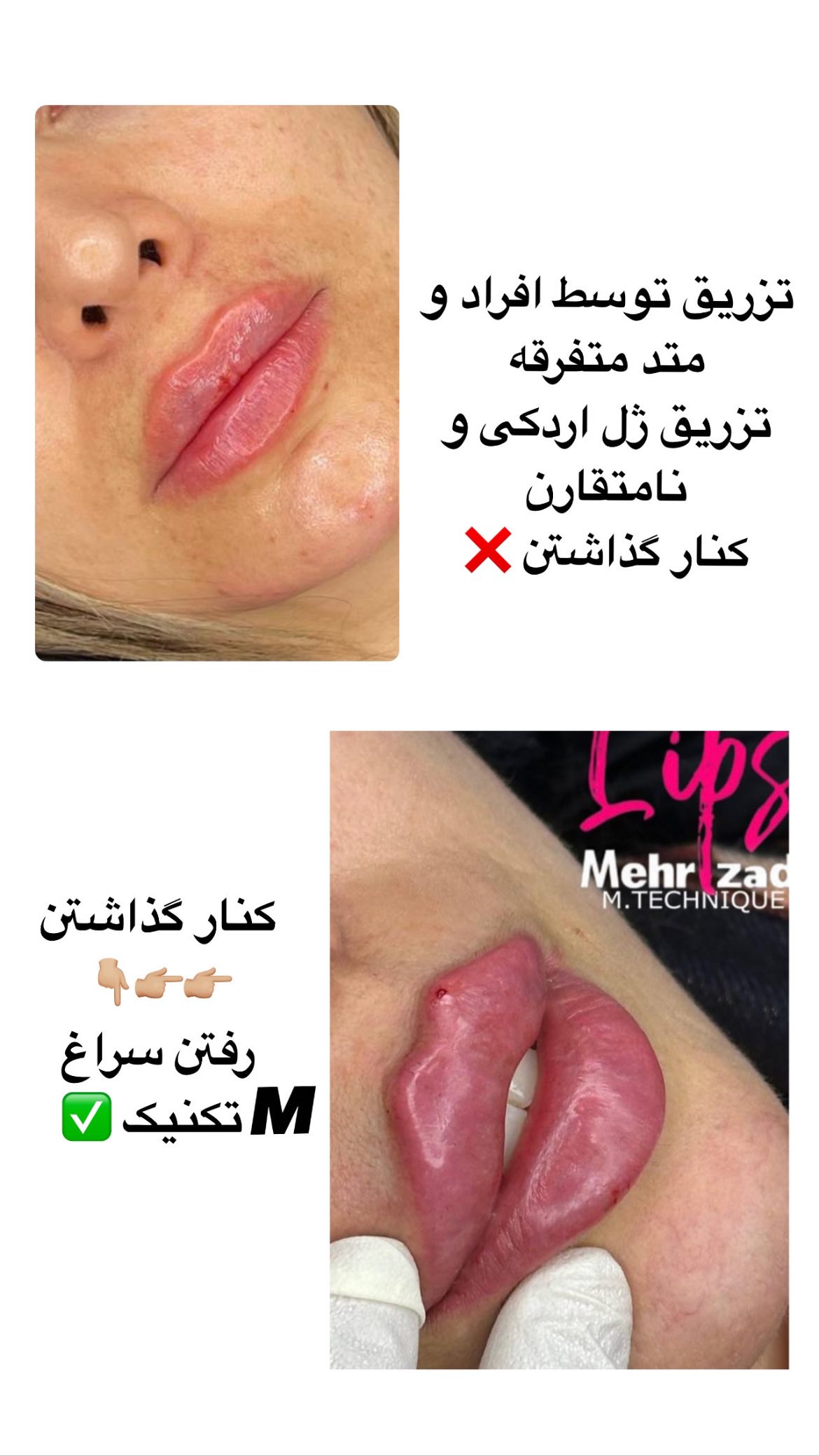  جدید ترین استوری اینستاگرام ریحانه نجاد