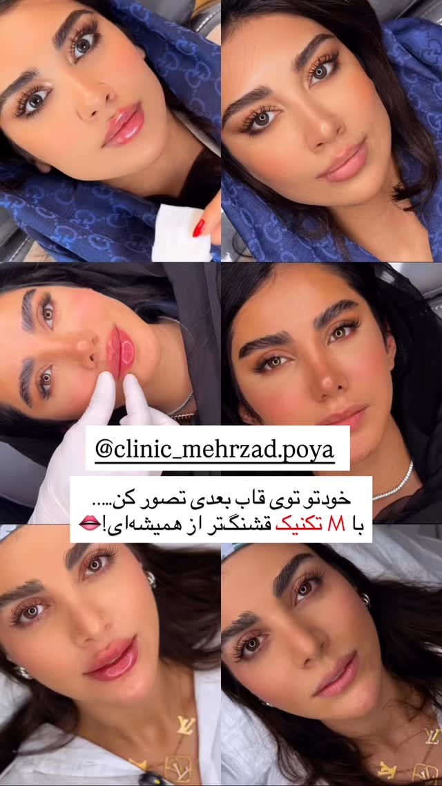  جدید ترین استوری اینستاگرام ریحانه نجاد