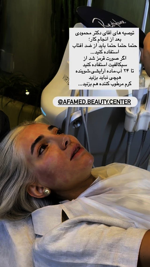  جدید ترین استوری اینستاگرام رز صمدی
