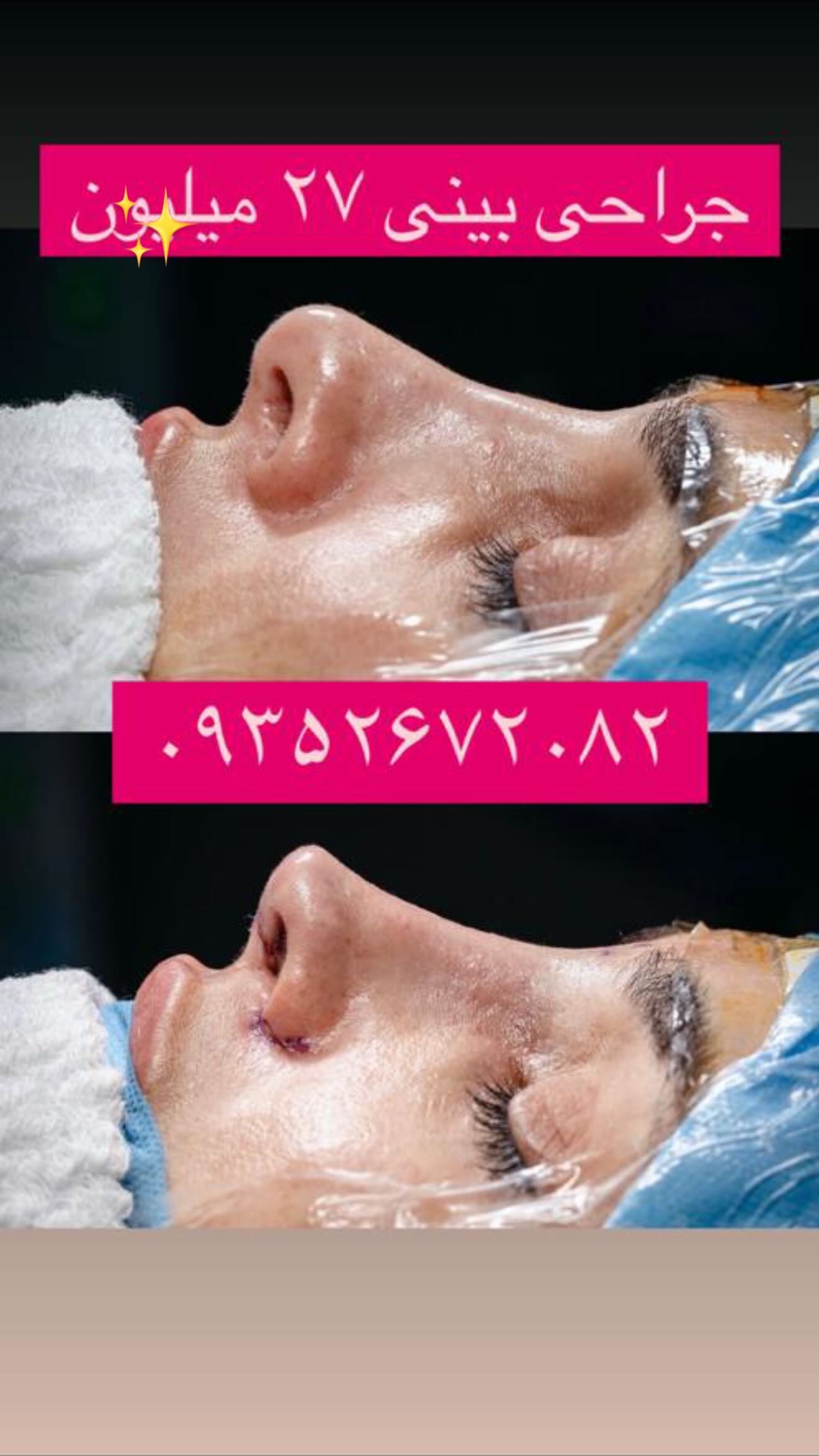  جدید ترین استوری اینستاگرام رویا و امیر حسام