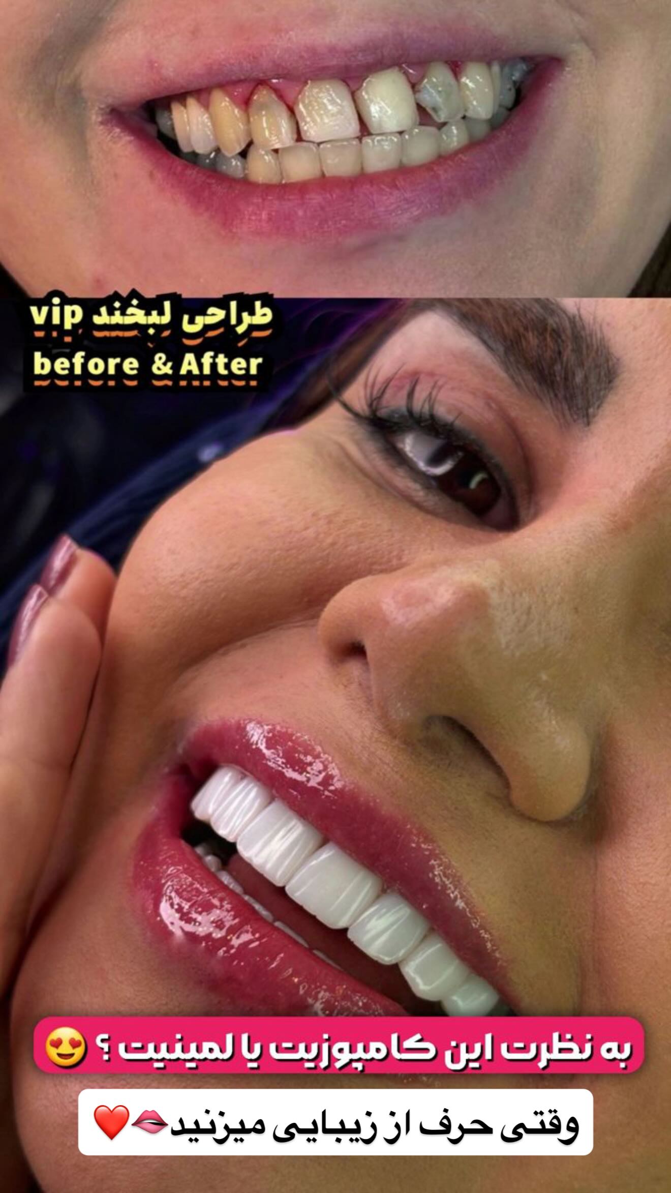  جدید ترین استوری اینستاگرام رویا و امیر حسام