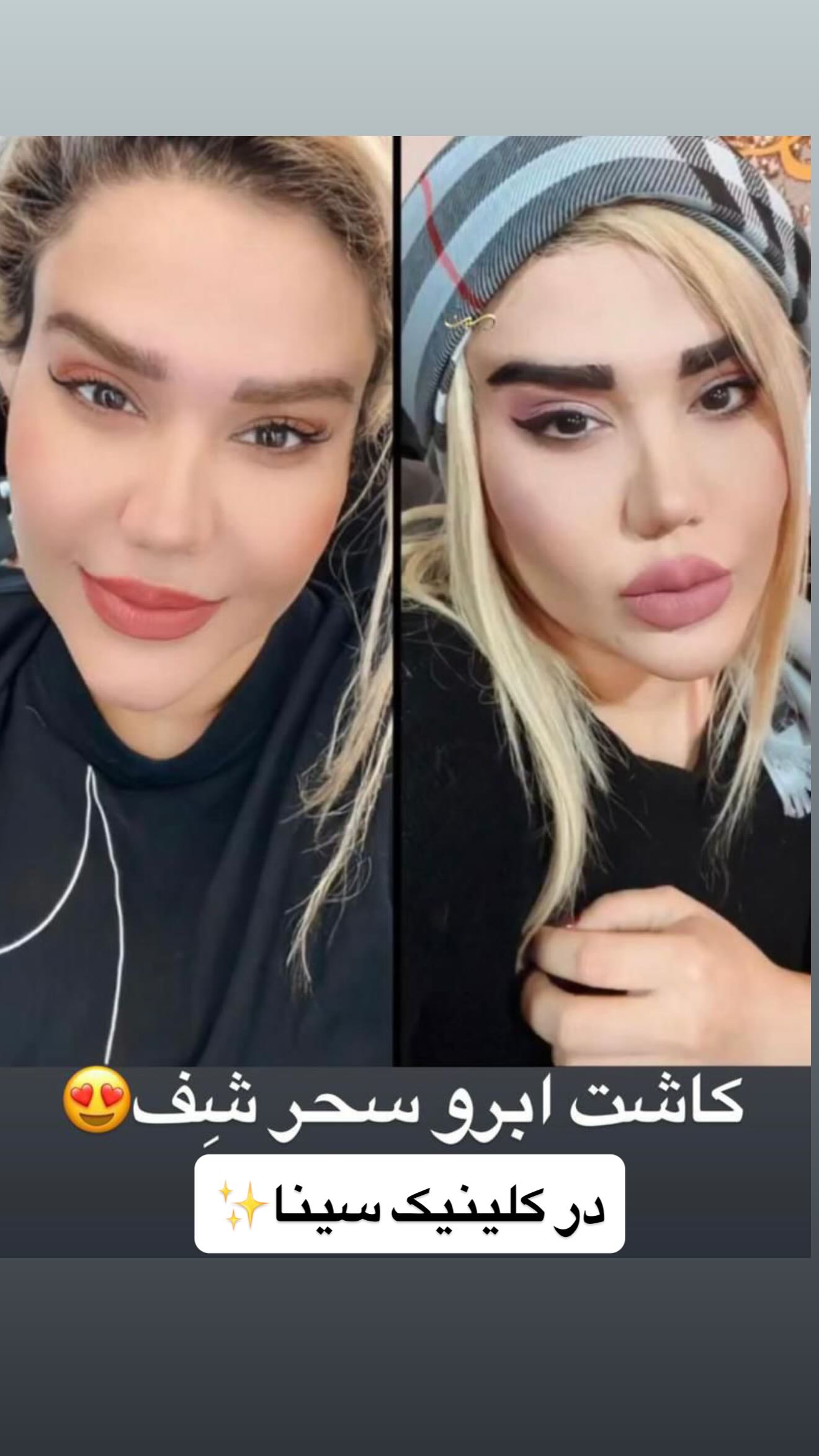  جدید ترین استوری اینستاگرام رویا و امیر حسام