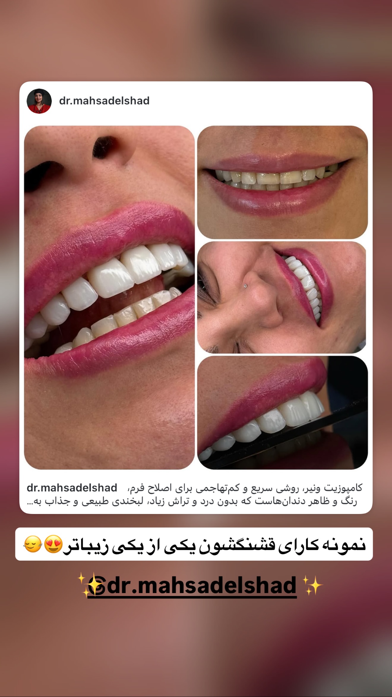  جدید ترین استوری اینستاگرام رویا
