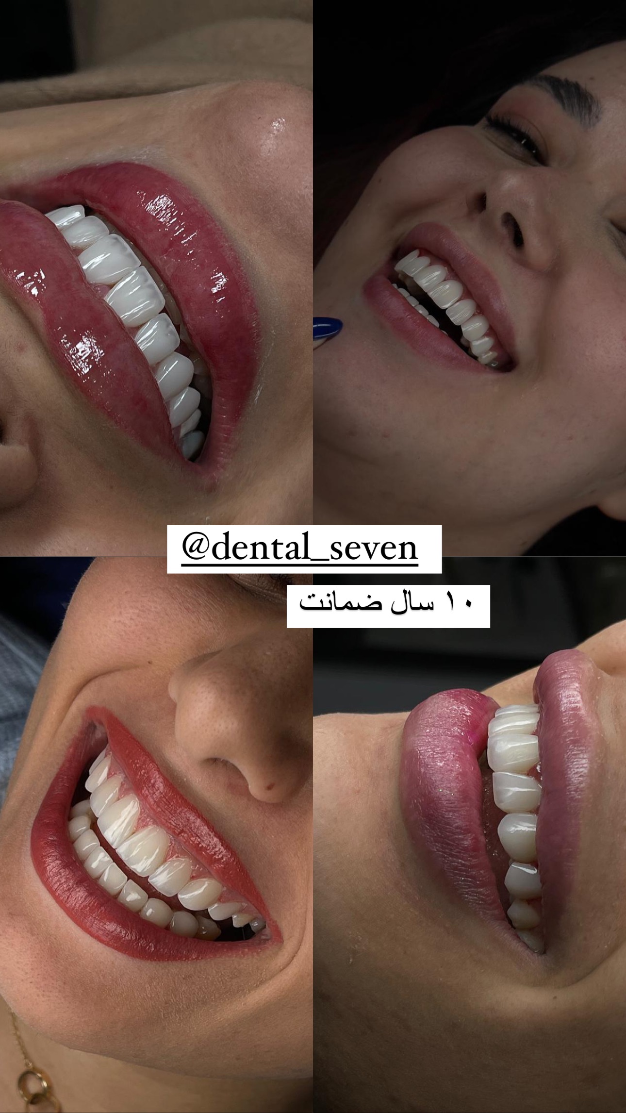  جدید ترین استوری اینستاگرام صبا مرشدی