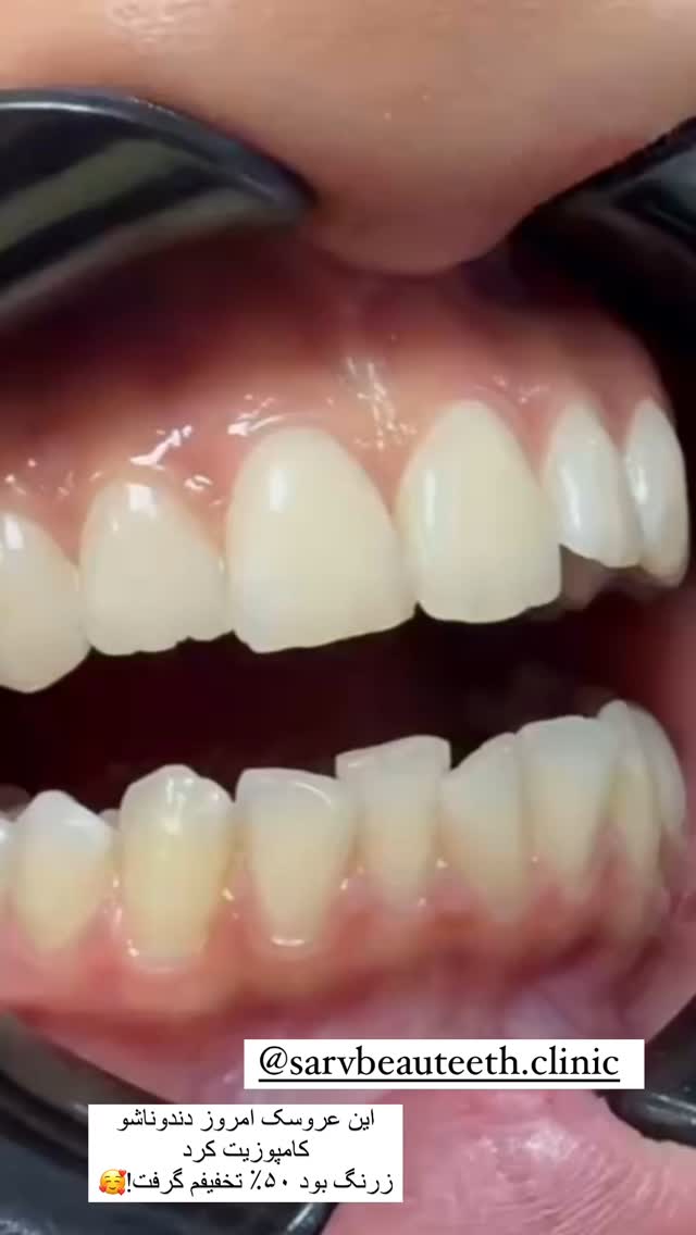  جدید ترین استوری اینستاگرام صبا مرشدی