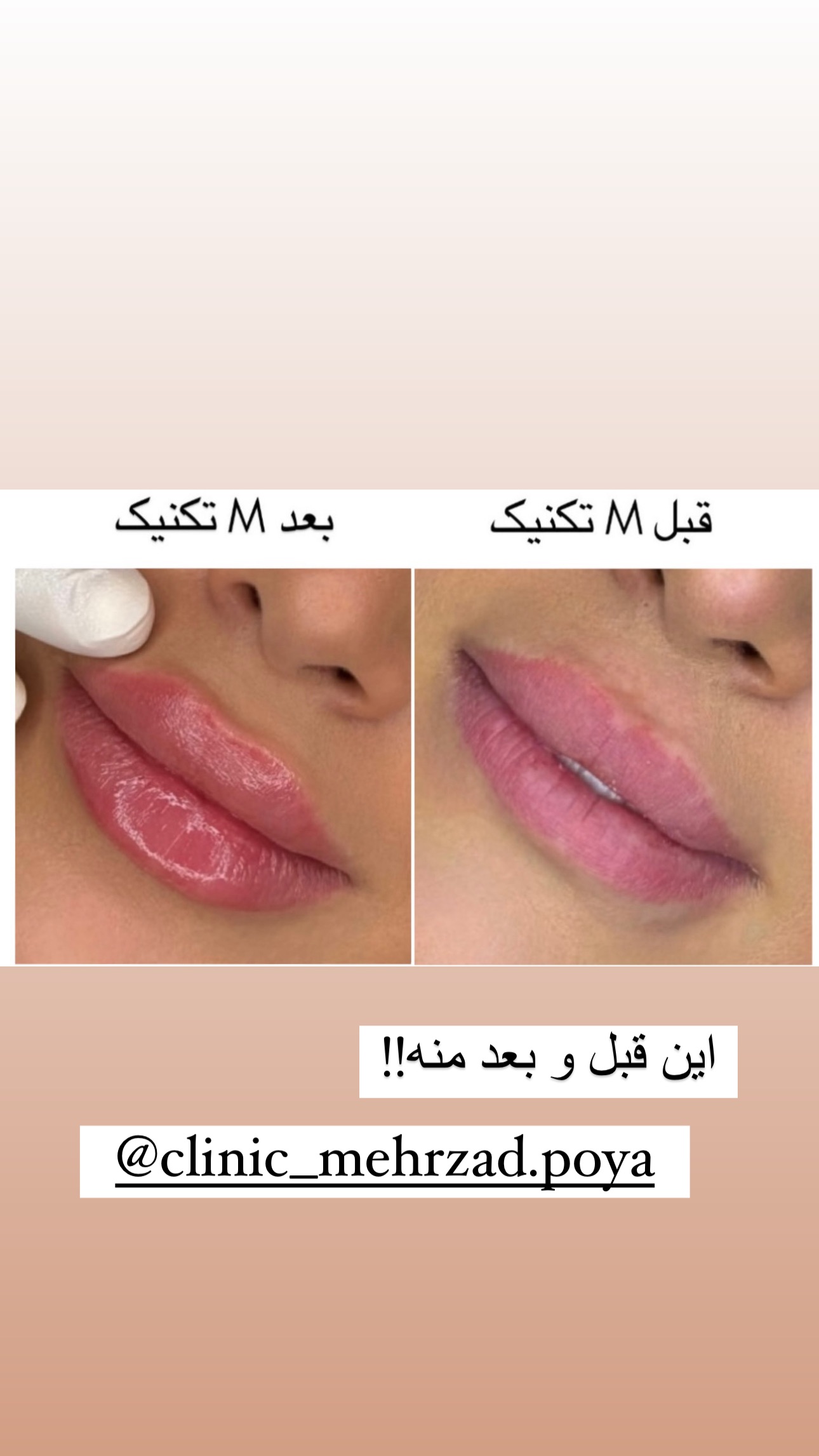  جدید ترین استوری اینستاگرام صبا مرشدی
