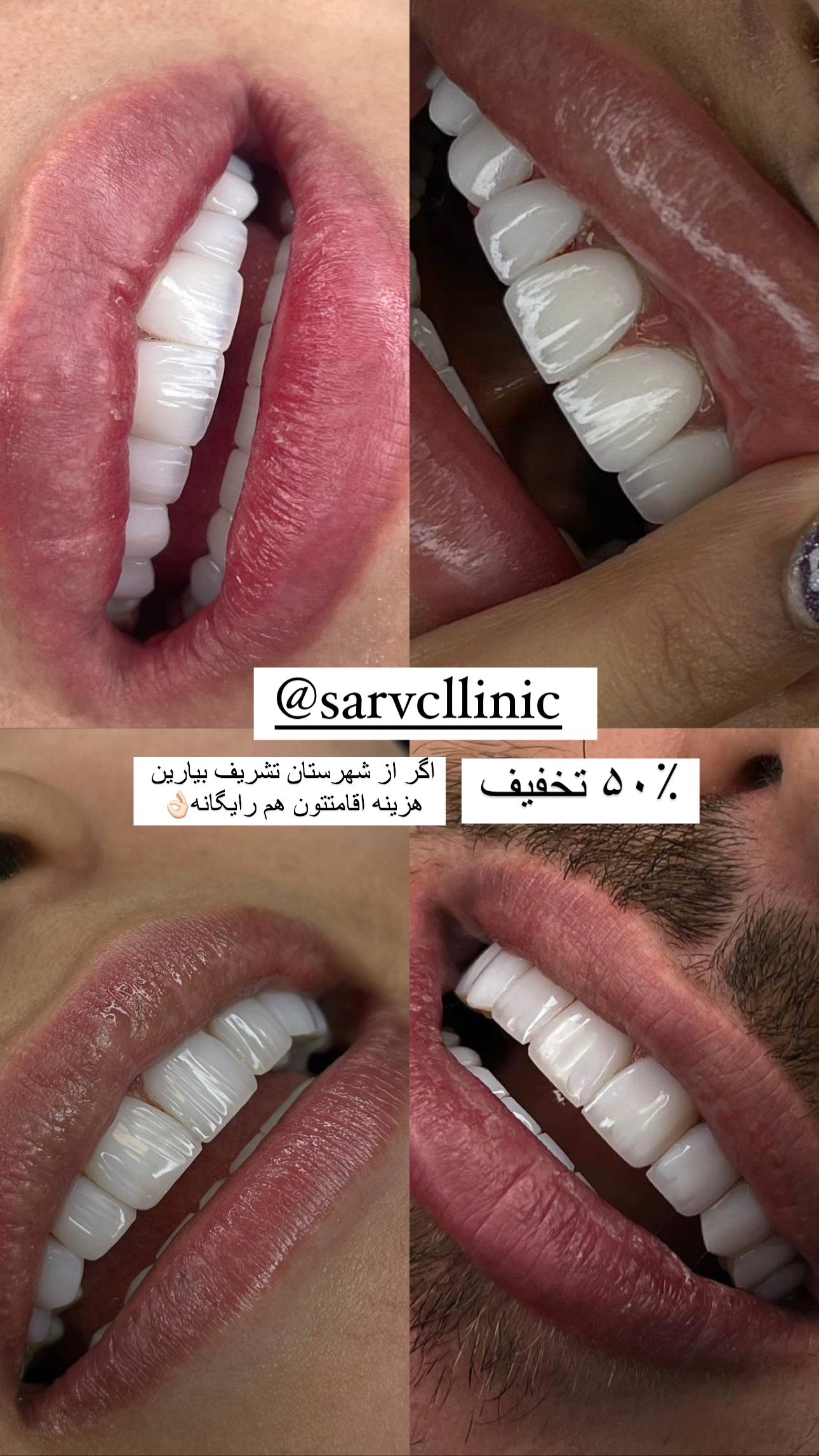  جدید ترین استوری اینستاگرام صبا مرشدی