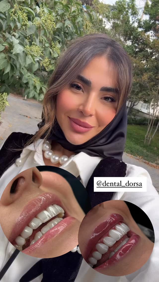  جدید ترین استوری اینستاگرام صبا مرشدی