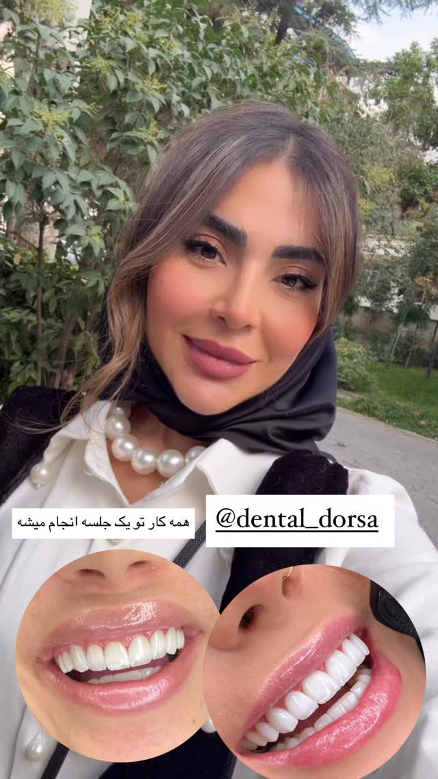  جدید ترین استوری اینستاگرام صبا مرشدی