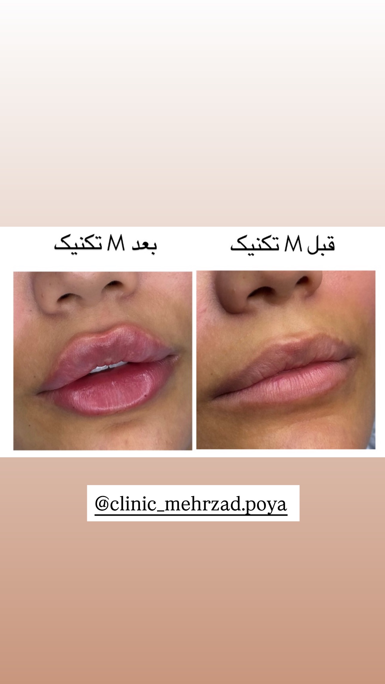  جدید ترین استوری اینستاگرام صبا مرشدی
