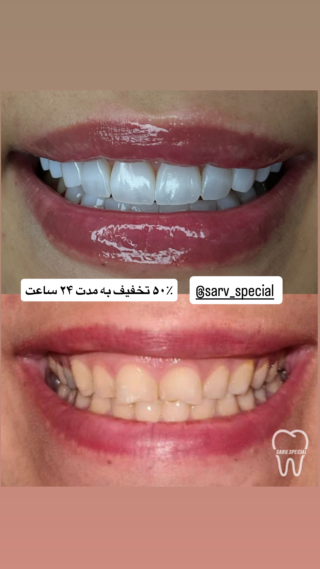  جدید ترین استوری اینستاگرام صبا مرشدی