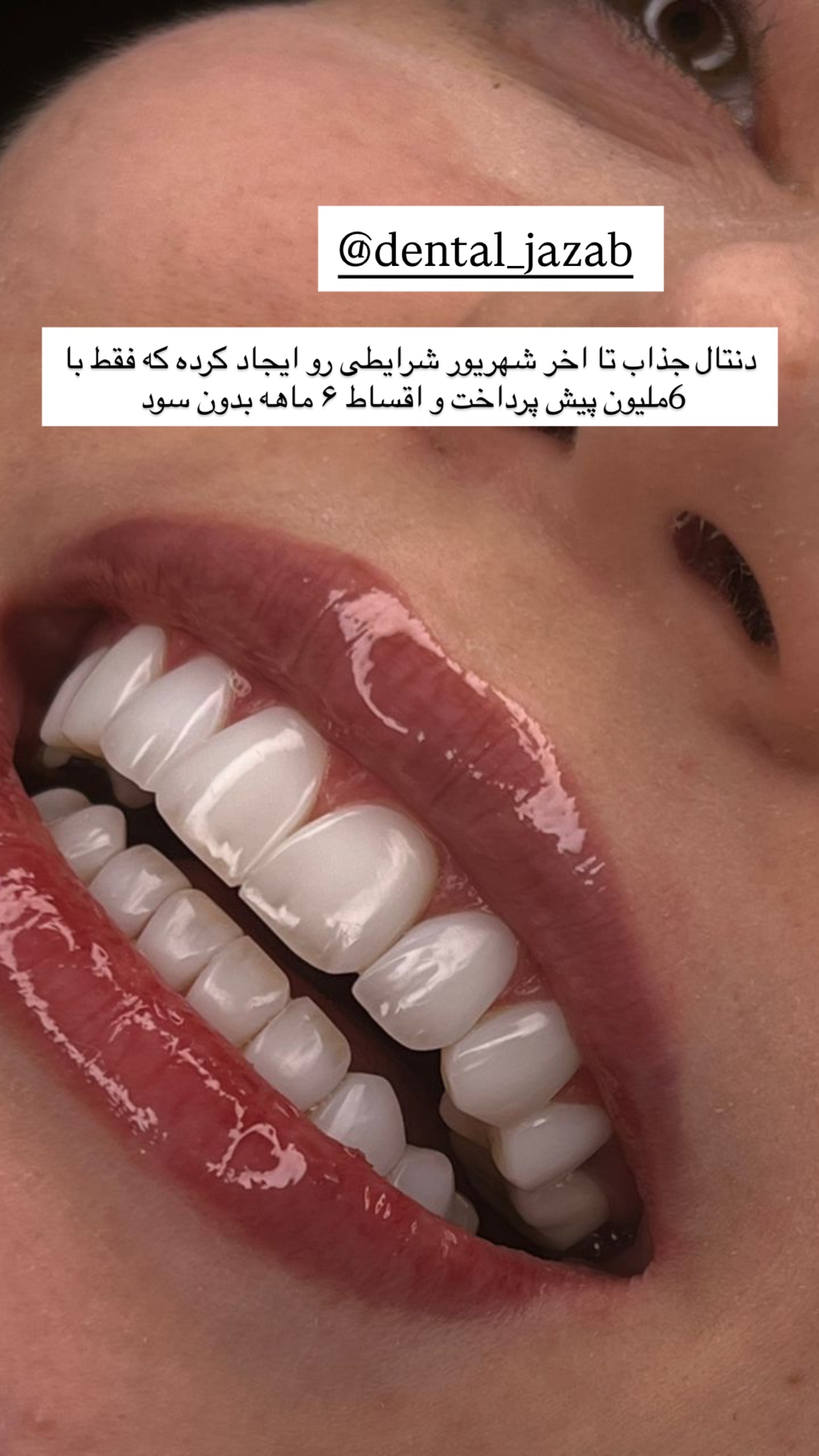  جدید ترین استوری اینستاگرام صبا مرشدی