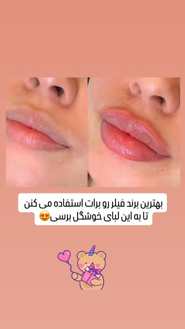  جدید ترین استوری اینستاگرام صبا راد