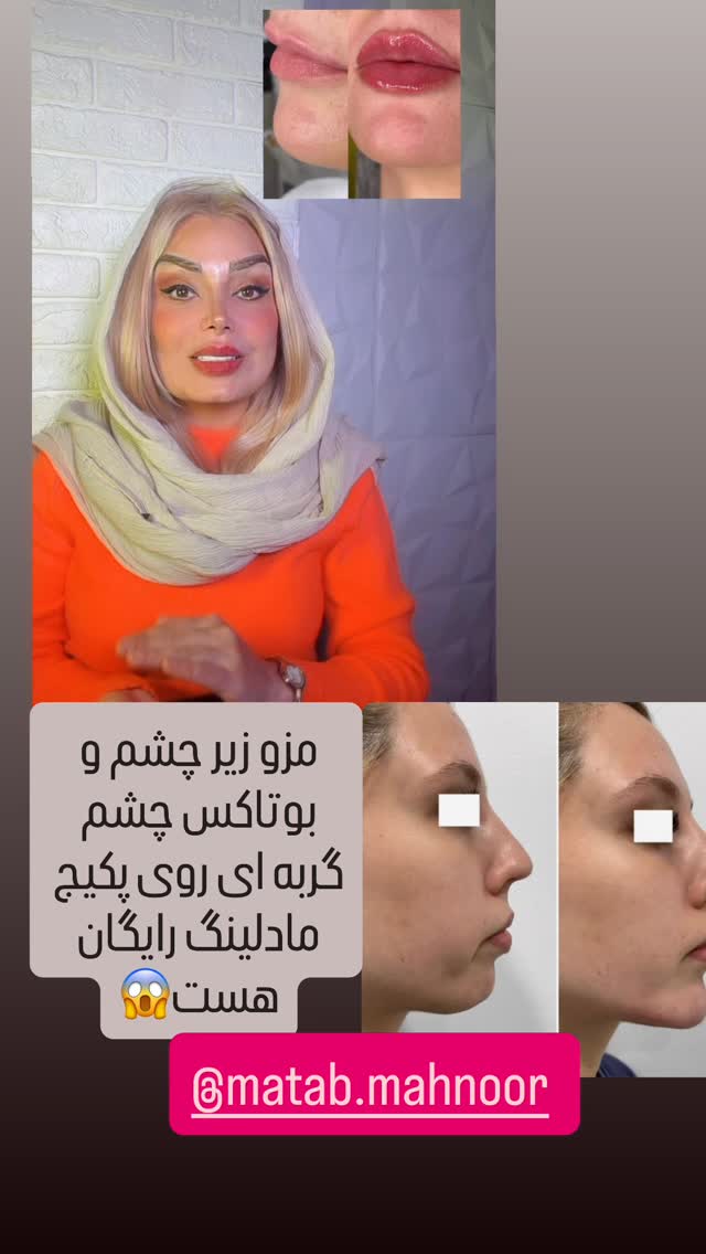  جدید ترین استوری اینستاگرام صبا راد