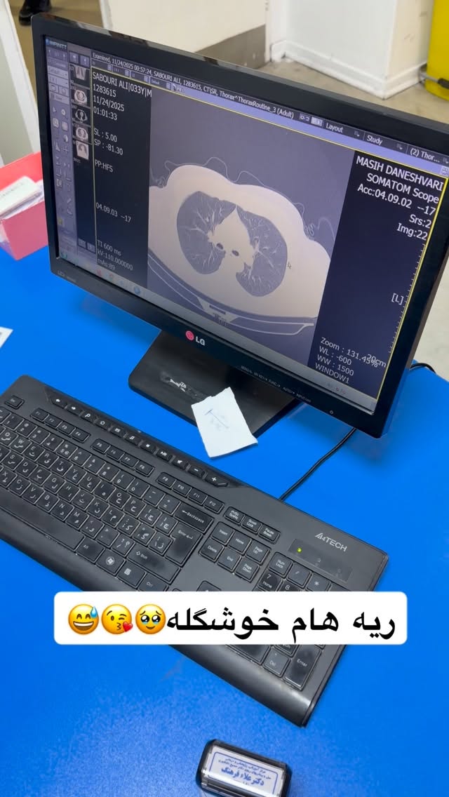  جدید ترین استوری اینستاگرام علی صبوری
