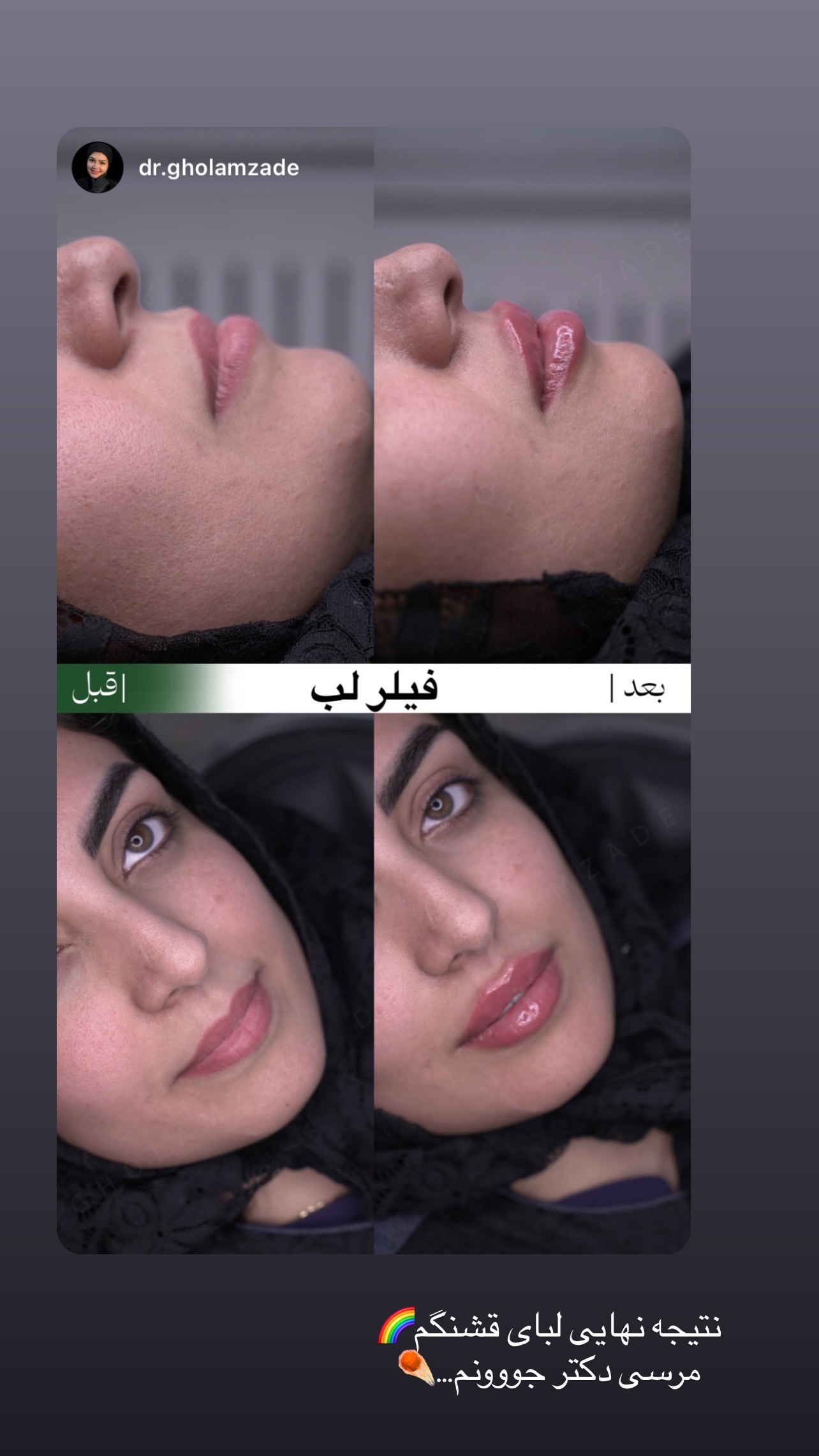  جدید ترین استوری اینستاگرام زینب سادات نوفرستی