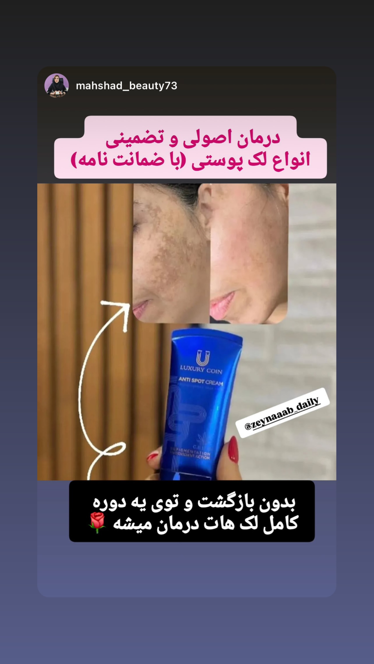  جدید ترین استوری اینستاگرام زینب سادات نوفرستی
