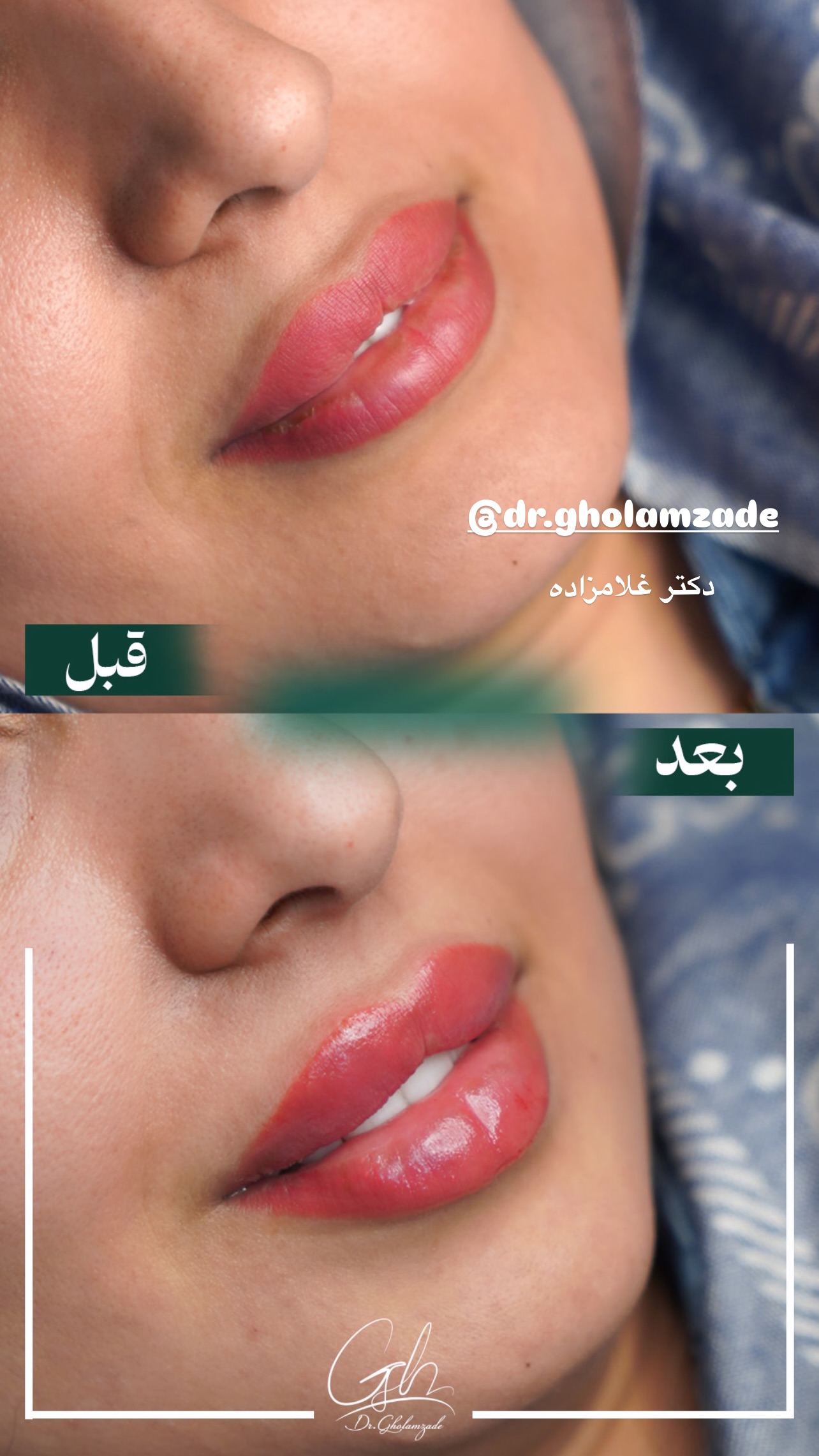  جدید ترین استوری اینستاگرام زینب سادات نوفرستی