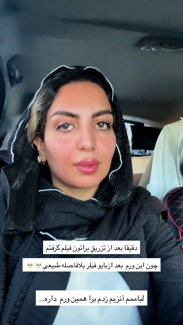  جدید ترین استوری اینستاگرام زینب سادات نوفرستی