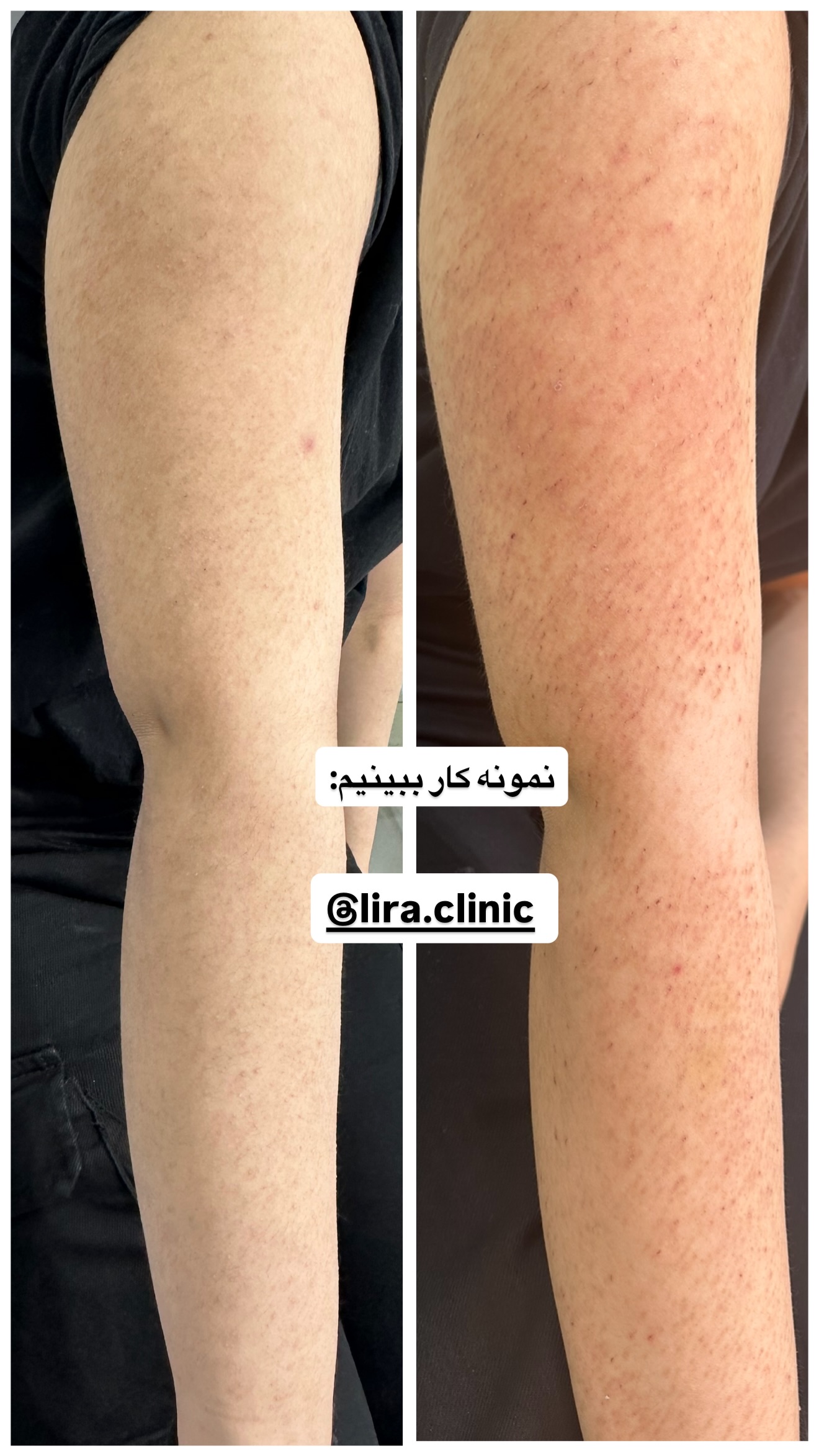  جدید ترین استوری اینستاگرام ثریا وحدتی نیا