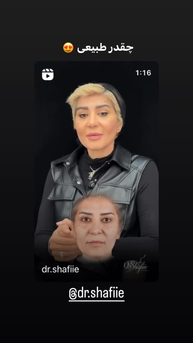 جدید ترین استوری اینستاگرام سلامت زنان