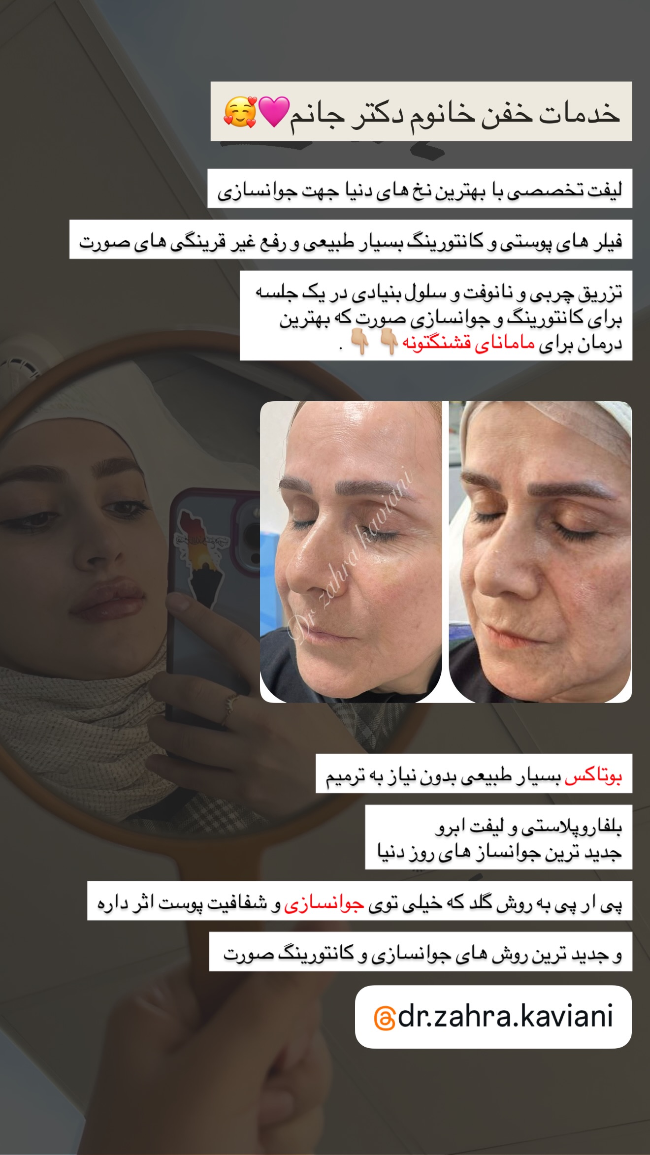 جدید ترین استوری اینستاگرام سلیم