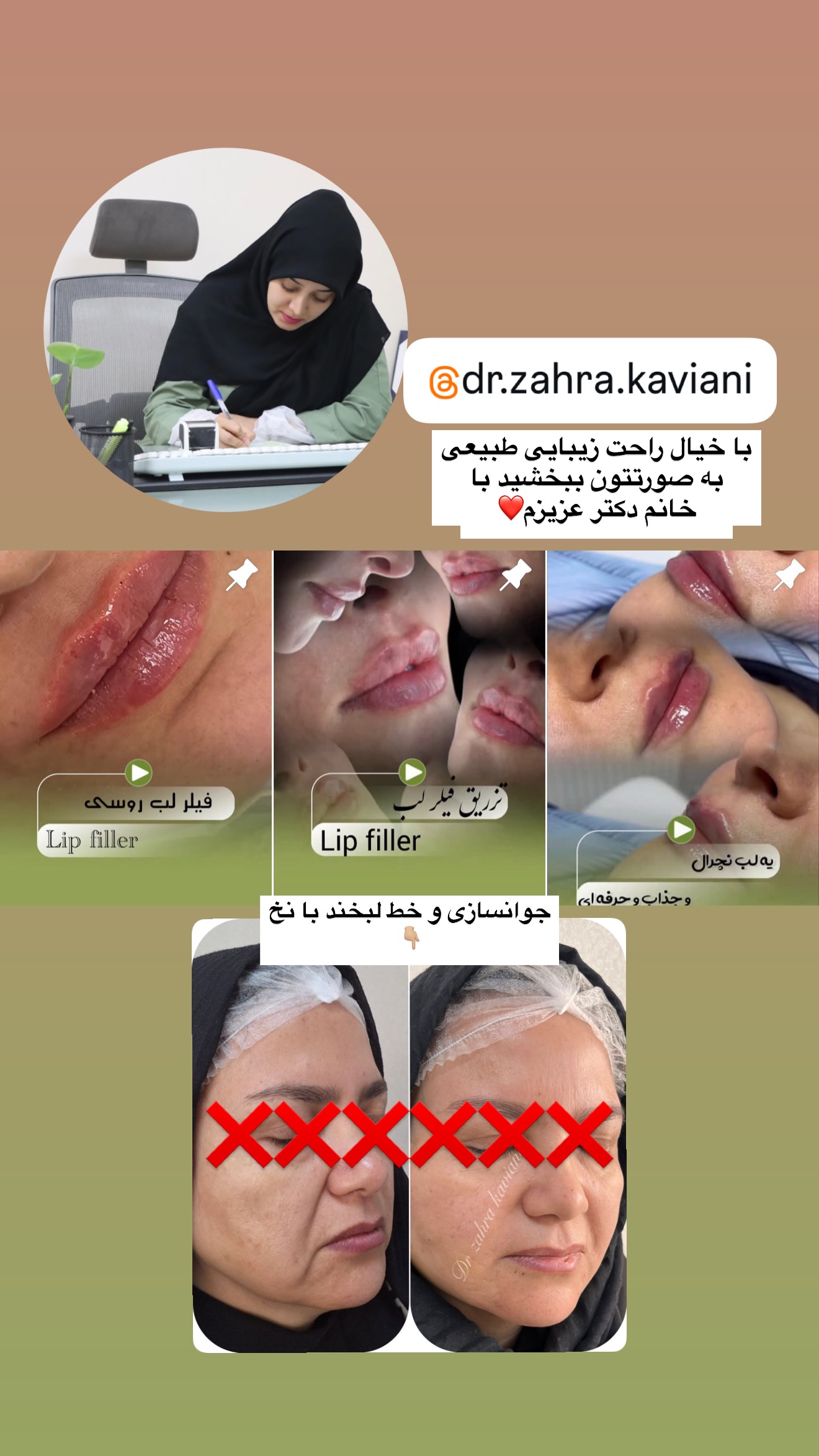  جدید ترین استوری اینستاگرام سلیم