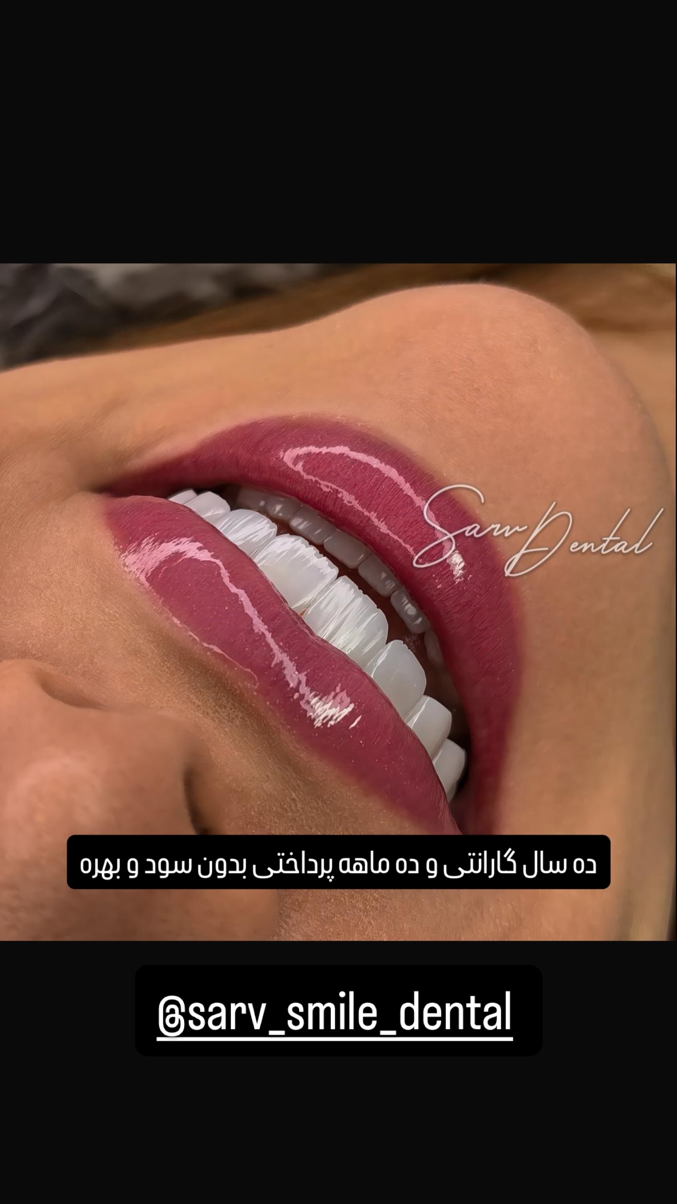  جدید ترین استوری اینستاگرام سما جعفرپور