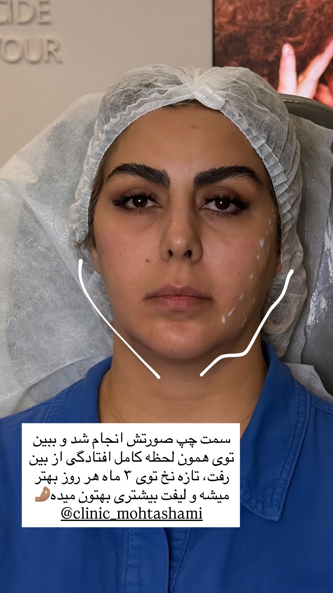  جدید ترین استوری اینستاگرام ساناز رستم پور