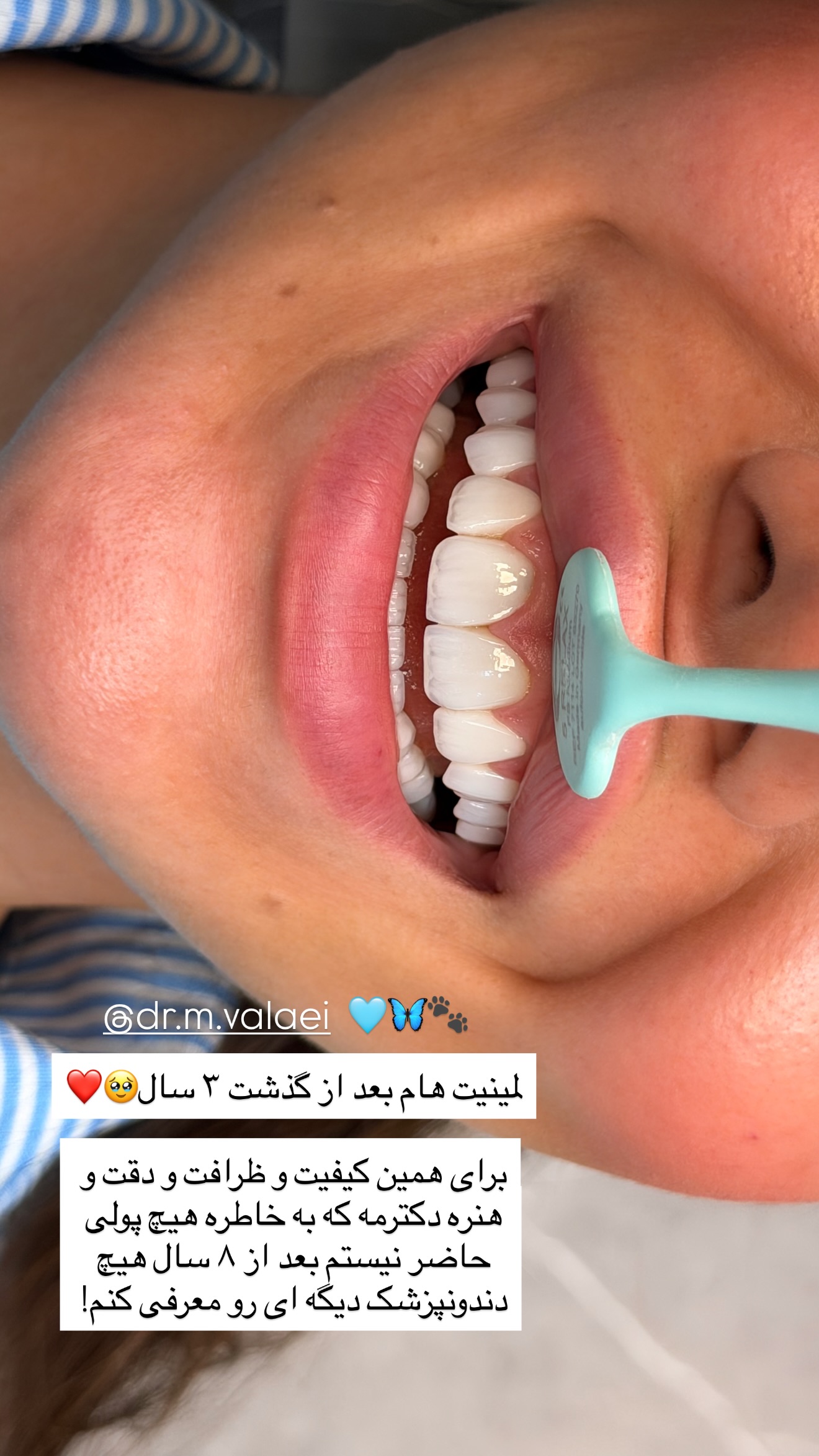  جدید ترین استوری اینستاگرام ساناز رستم پور