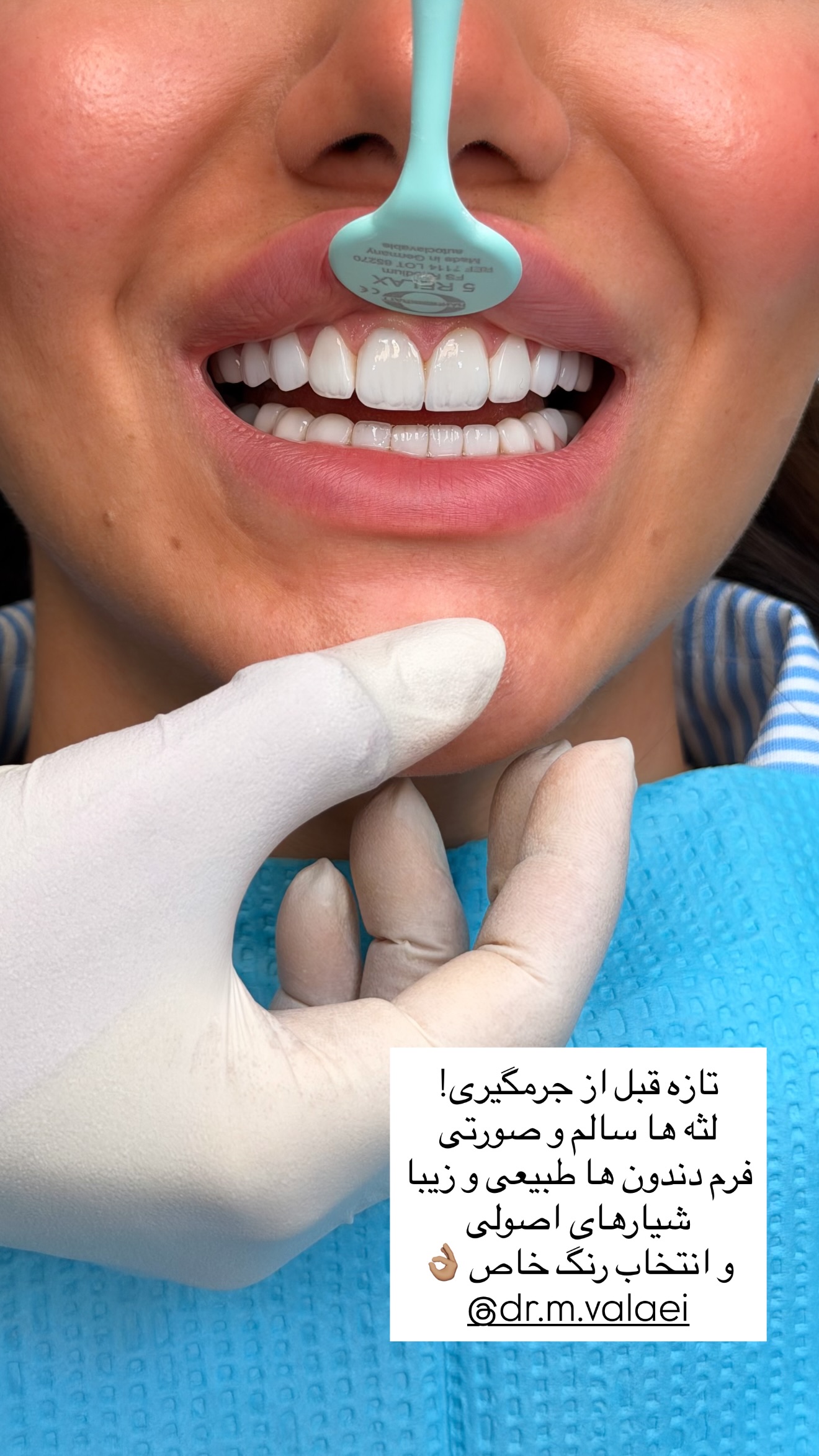  جدید ترین استوری اینستاگرام ساناز رستم پور