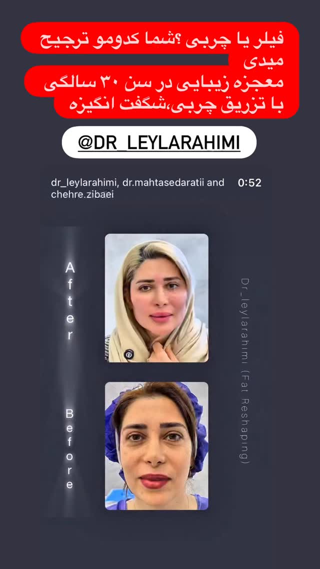  جدید ترین استوری اینستاگرام سارا سيلور