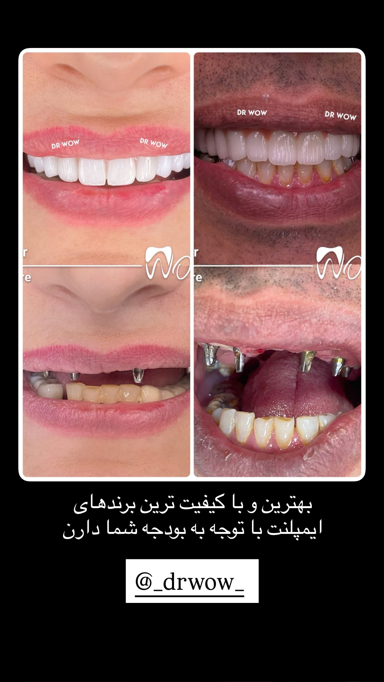  جدید ترین استوری اینستاگرام سارا حیدری