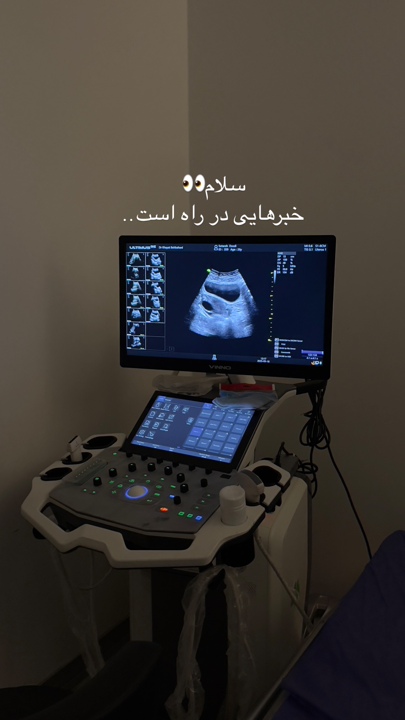  جدید ترین استوری اینستاگرام ستاره داودی