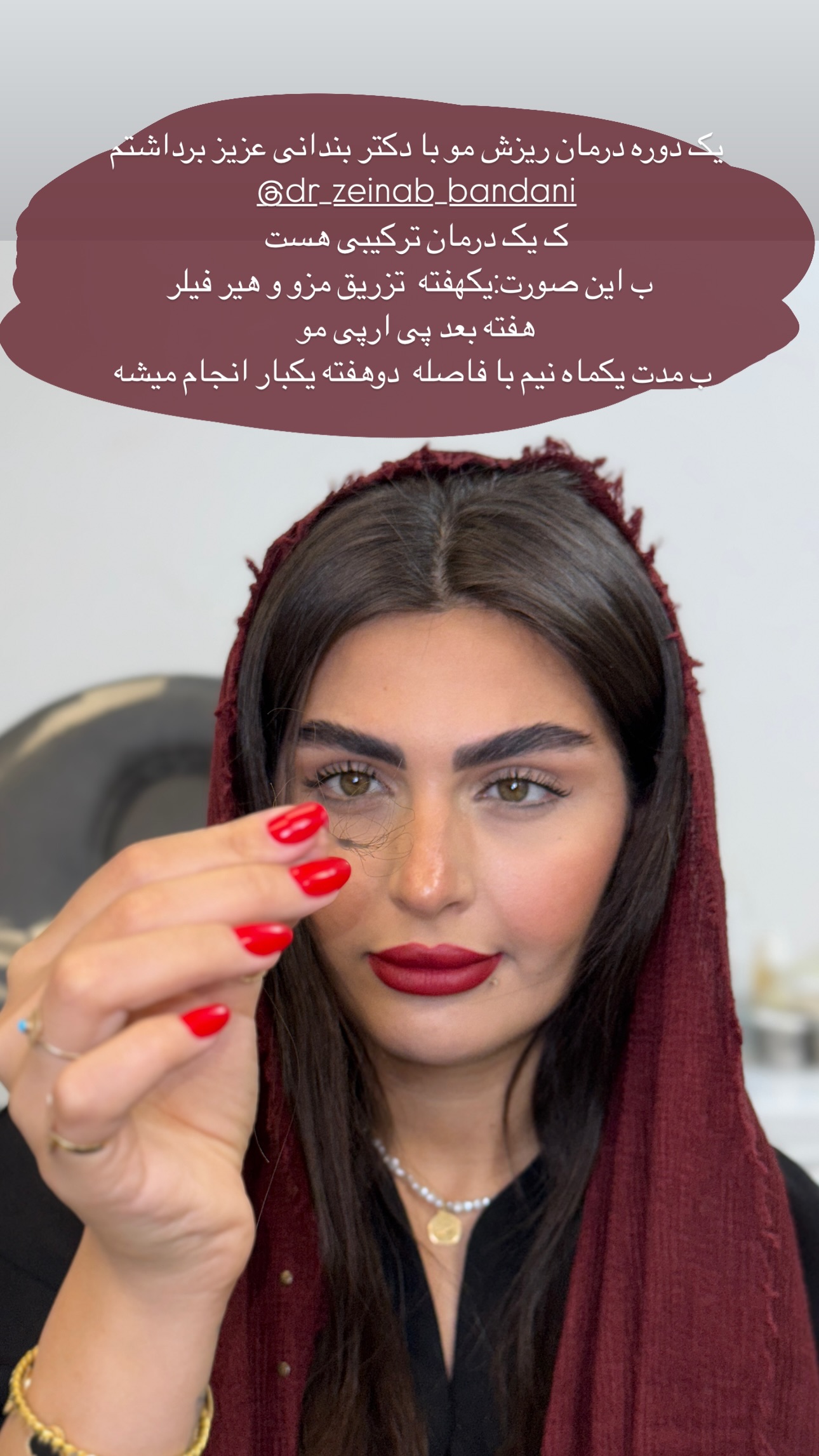  جدید ترین استوری اینستاگرام ستاره داودی