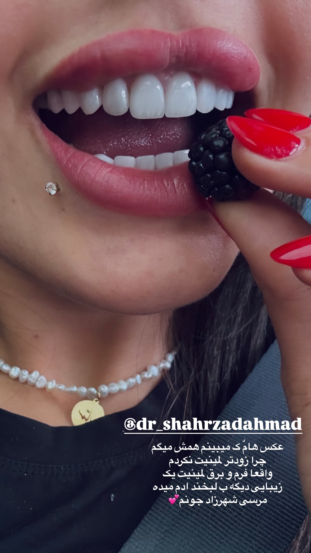  جدید ترین استوری اینستاگرام ستاره داودی